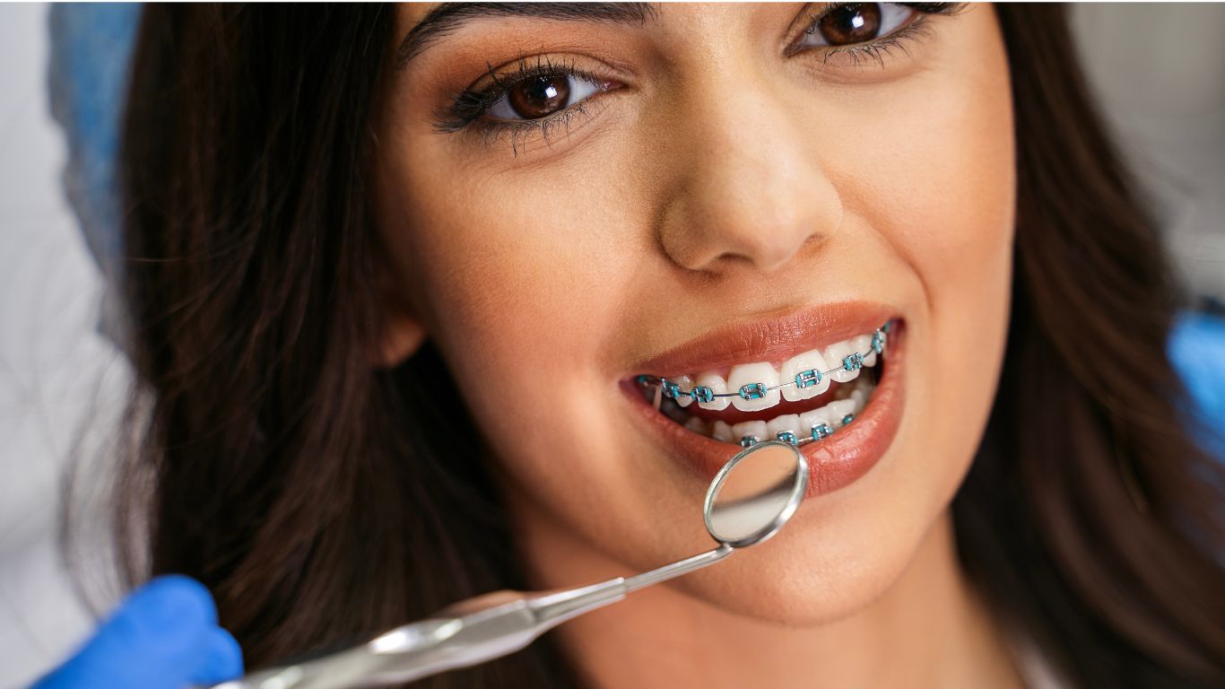 Dental Probiotics Benefits